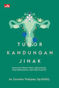Image of Tumor kandungan jinak